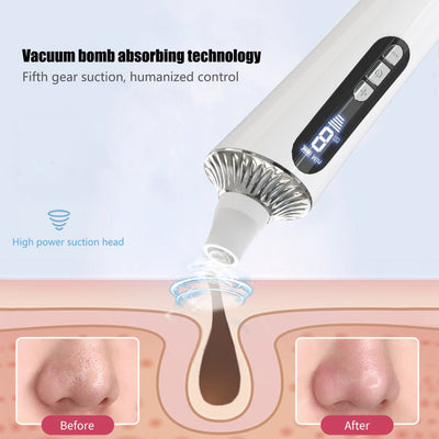 Electric Blackhead Remover Facial Pore Cleaner Skin Care Beauty Devices Face Deep Nose Cleaner Vacuum Suction Lackhead Remover